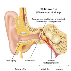 Mittelohrentzündung, Otitis media
