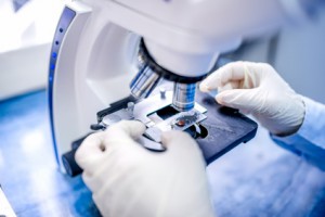 Der Frauenarzt kann Zellen eines Abstriches unter dem Mikroskop analysieren